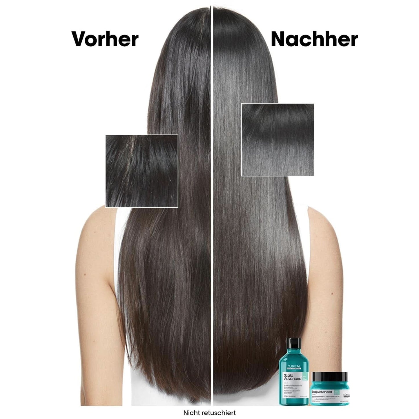 L'Oréal Professionnel rensende shampoo til fedtet hovedbund, 300 ml Naty Shop brusebad og bad