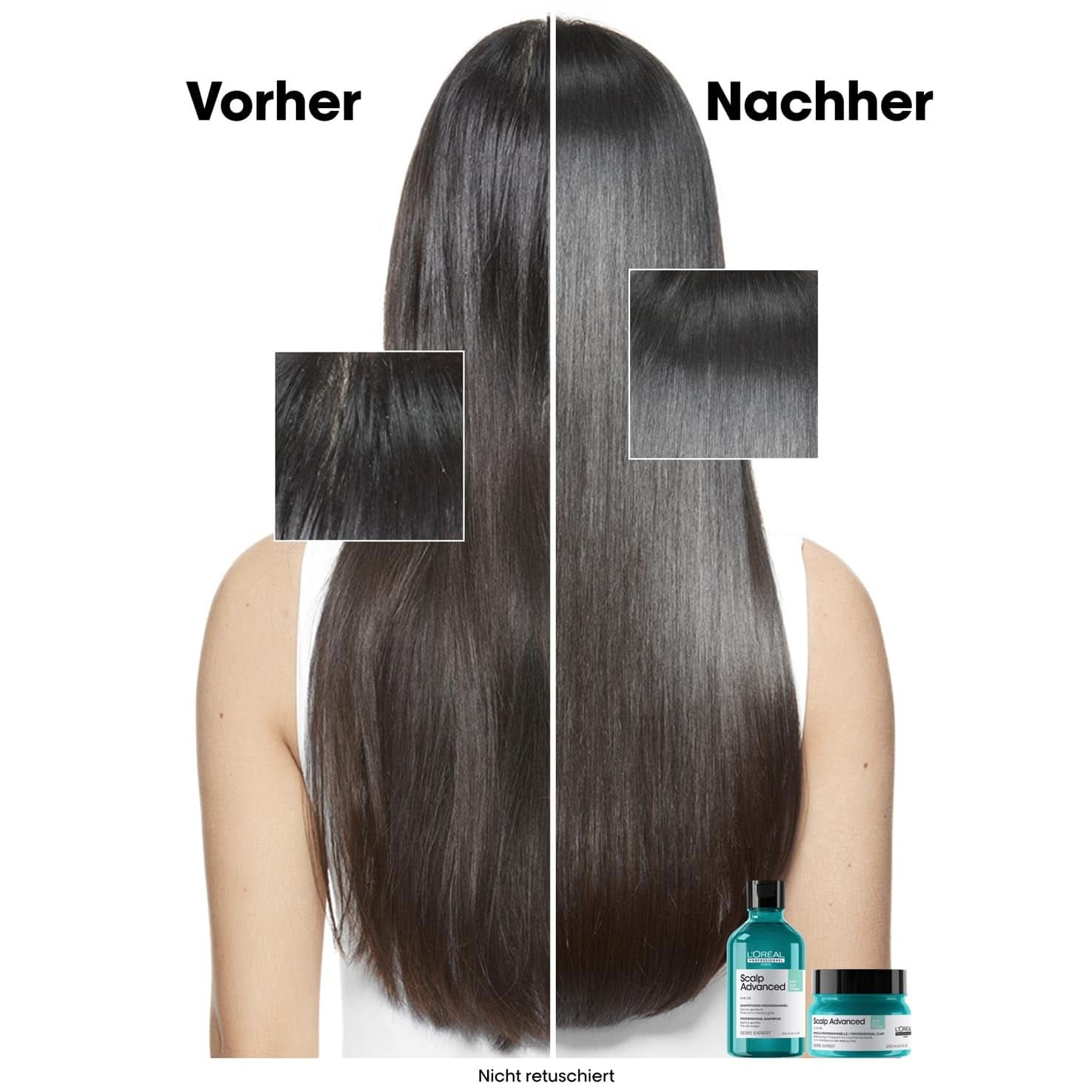 L'Oréal Professionnel rensende shampoo til fedtet hovedbund, 300 ml Naty Shop brusebad og bad