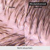L'Oréal Professionnel rensende shampoo til fedtet hovedbund, 300 ml Naty Shop brusebad og bad