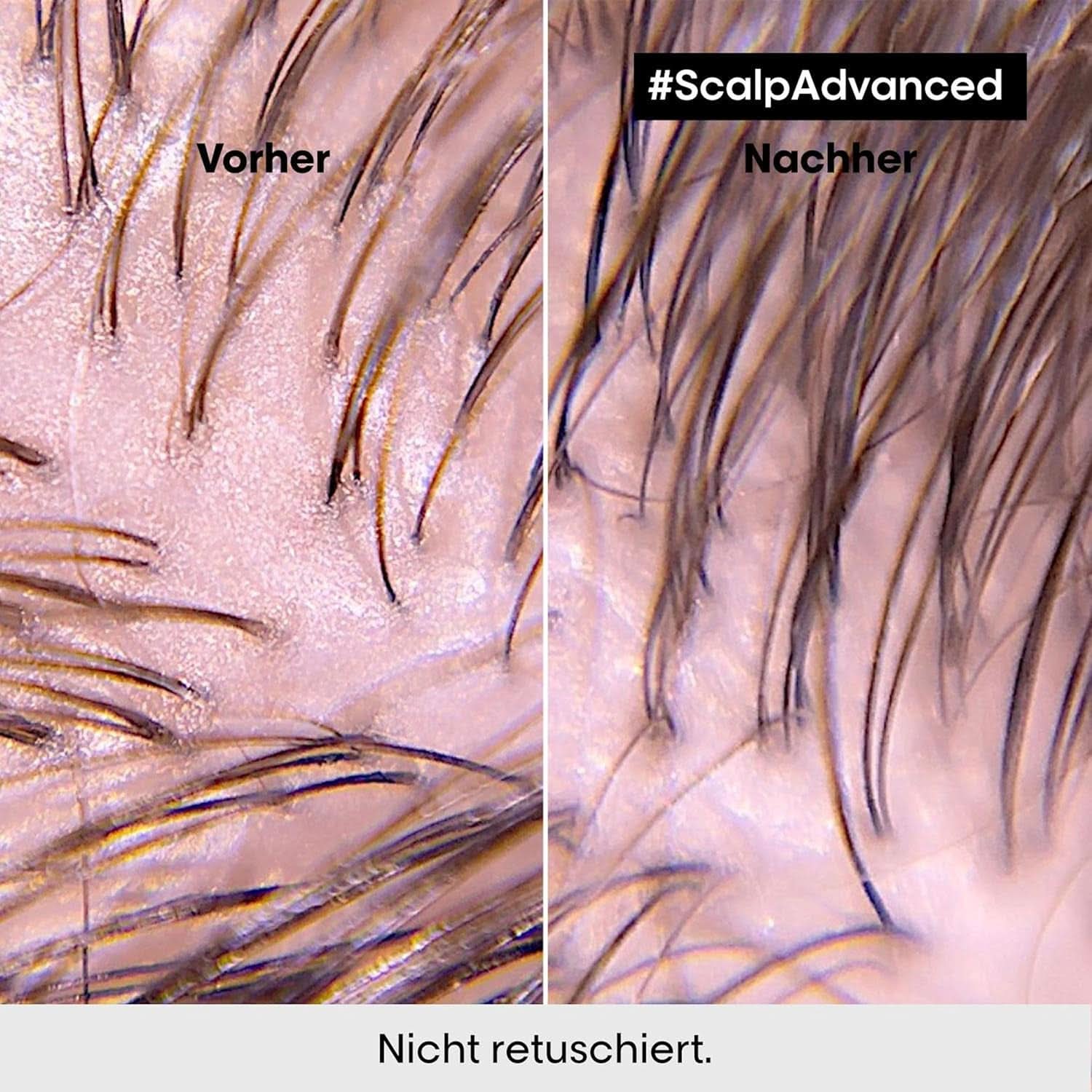 L'Oréal Professionnel rensende shampoo til fedtet hovedbund, 300 ml Naty Shop brusebad og bad