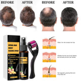 Advanced Hair Growth Treatment Kit 30ml 2 STK Hair Growth Spray Hårvækst Roller og Essence Set Hair Growth Serum Anti Hårtab Advanced Hair Growth Serum Hair Care Naty Shop
