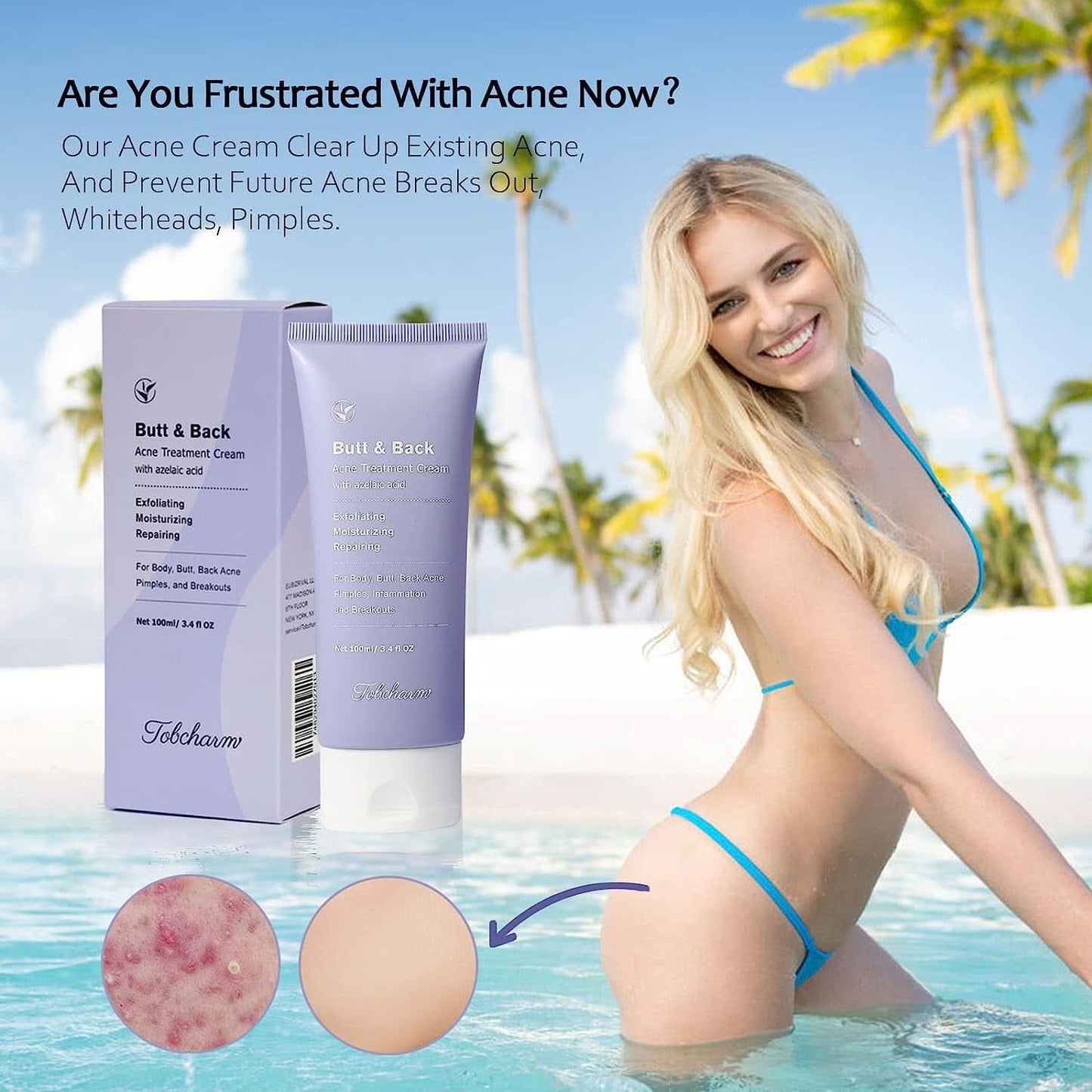 Anti-akne creme, 100 ml Kosmetik og skønhed Naty Shop