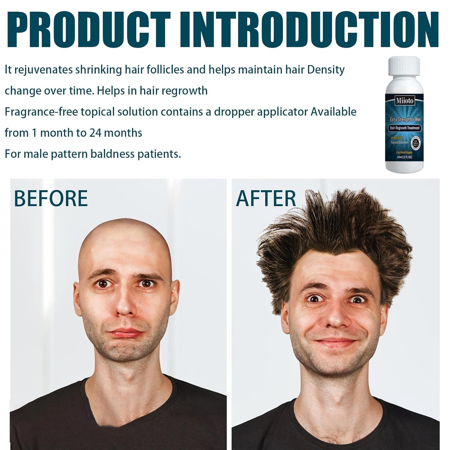 Miioto Hårvækst Serum Mænd Hårvækst Produkt Hårvækst Hår Serum Hovedbundspleje Fremme tykkere hår Nærer hovedbunden Forhindrer hårtab 3*60ML Hårpleje Naty Shop