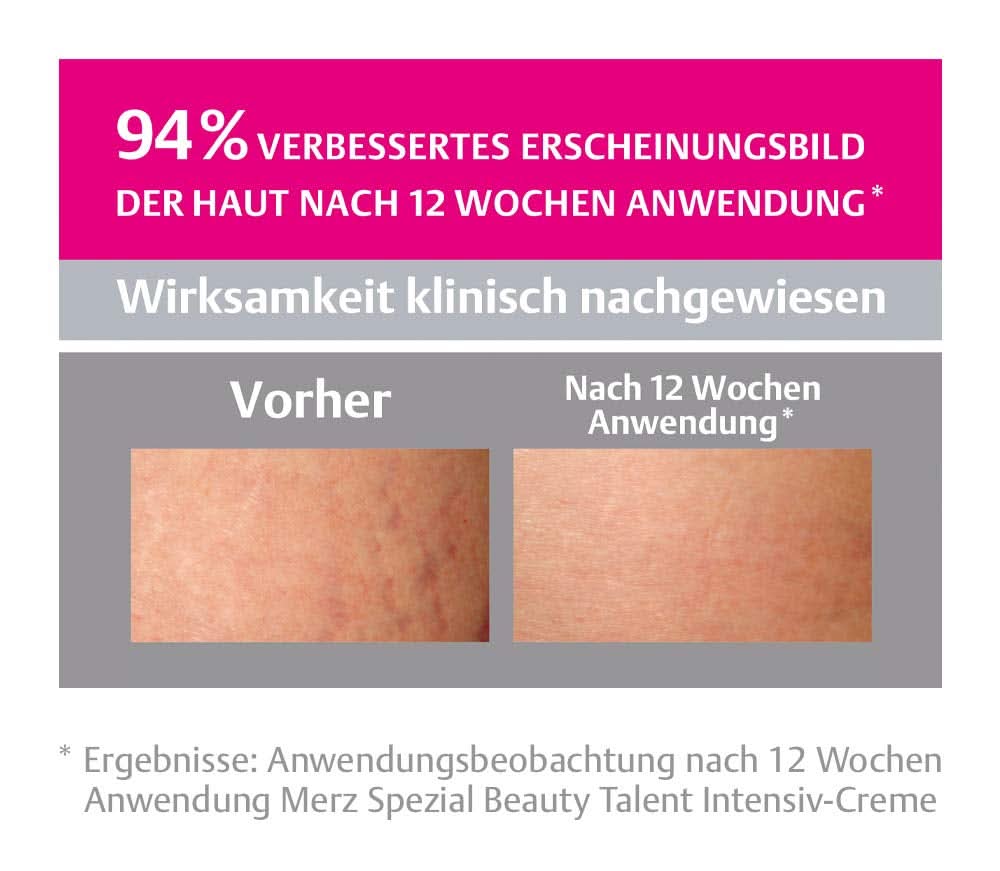 Merz Spezial, Intensiv creme mod strækmærker, 75 ml Cosmetics and Beauty Naty Shop