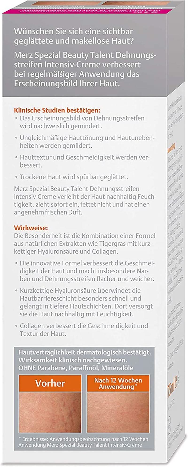 Merz Spezial, Intensiv creme mod strækmærker, 75 ml Cosmetics and Beauty Naty Shop