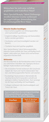 Merz Spezial, Intensiv creme mod strækmærker, 75 ml Cosmetics and Beauty Naty Shop
