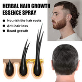 Advanced Hair Growth Treatment Kit 30ml 2 STK Hair Growth Spray Hårvækst Roller og Essence Set Hair Growth Serum Anti Hårtab Advanced Hair Growth Serum Hair Care Naty Shop