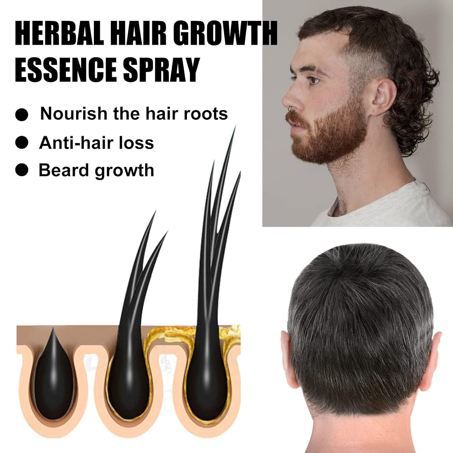 Advanced Hair Growth Treatment Kit 30ml 2 STK Hair Growth Spray Hårvækst Roller og Essence Set Hair Growth Serum Anti Hårtab Advanced Hair Growth Serum Hair Care Naty Shop